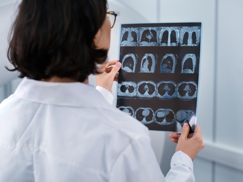 Best Neurosurgeon in Ranchi | 8 Silent Signs of Brain Tumor